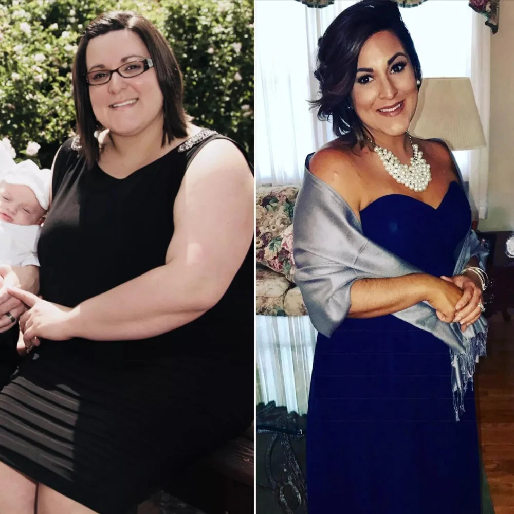 Before/After